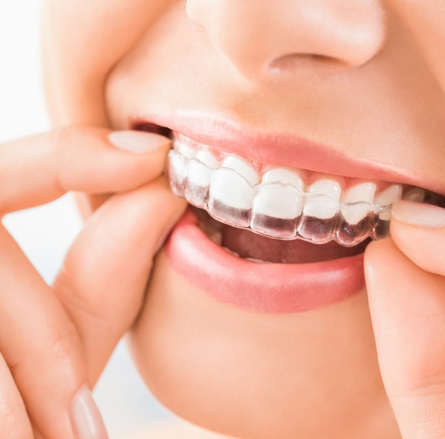 Woman With Braces Smiles While Holding Her Teeth at Meadville Pennsylvania