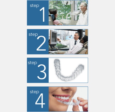 Steps Involved In Using Clear Aligners at Dr Shok Office Meadville Pennsylvania