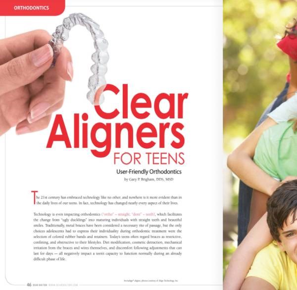 Clear Aligners for Teenagers Article at Meadville Pennsylvania