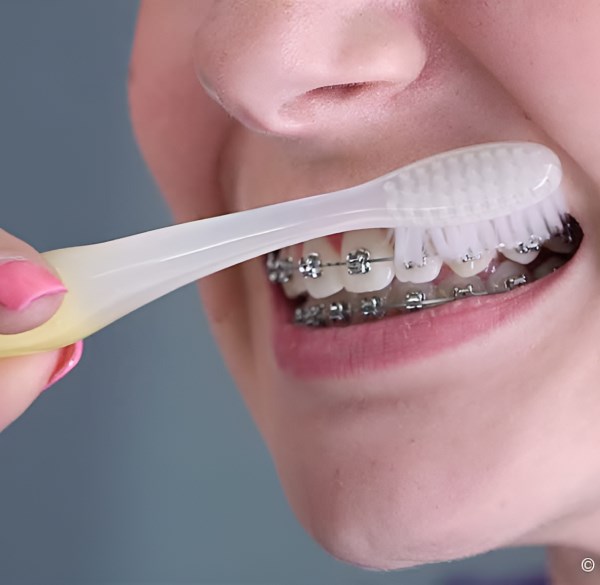 Woman Is Brushing Her Teeth With A Toothbrush at Dr Shok Office Meadville Pennsylvania