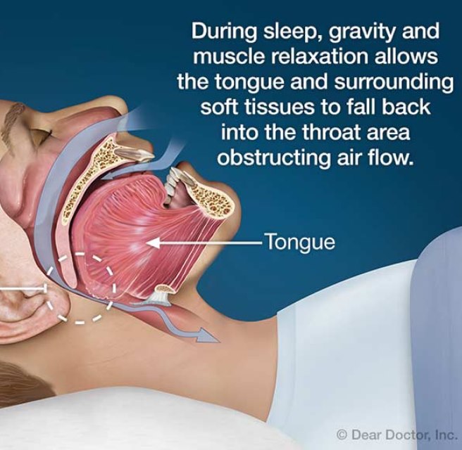 Anatomy Of The Throat And Tongue at Dr Shok Office Meadville Pennsylvania