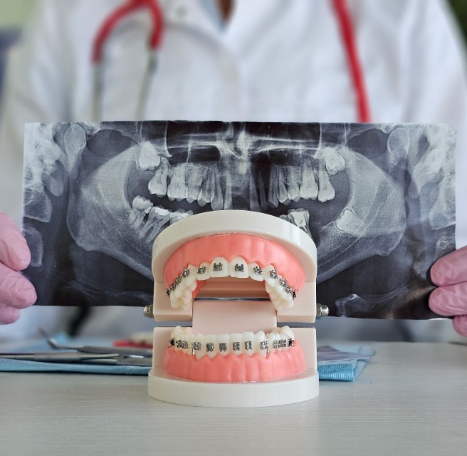 Doctor Displays A Tooth Model With Braces at Meadville Pennsylvania